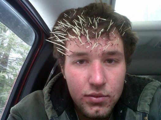 human porcupine